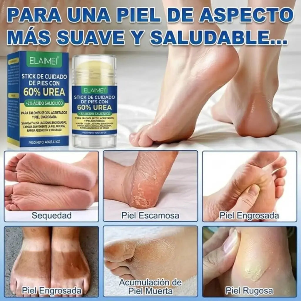 RootAura™ Crema para talones secos y agrietados